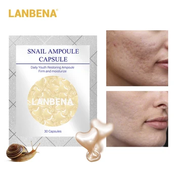 LANBENA Snail Moisturizing Ampoules Capsule Face Cream Serum Skin Whitening Anti-Aging Treatment Acne Hyaluronic Acid 30 Grain
LANBENA Snail Moisturizing Ampoules Capsule Face Cream Serum Skin Whitening Anti-Aging Treatment Acne Hyaluronic Acid 30 Grain