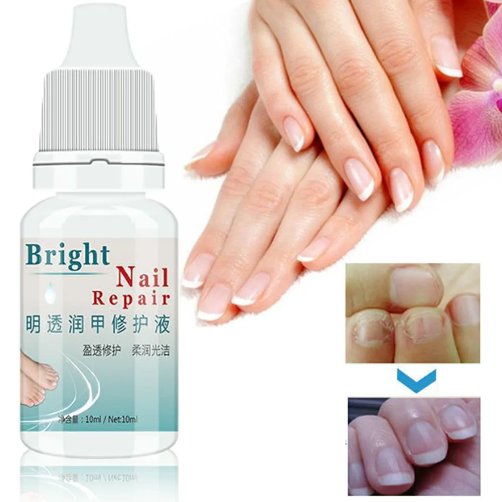 10ml Nail Treatment Natural Professional Sterilization Nourish Herbal Transparent Smooth Bright Nail Repair Essential Oil
10ml Nail Treatment Natural Professional Sterilization Nourish Herbal Transparent Smooth Bright Nail Repair Essential Oil