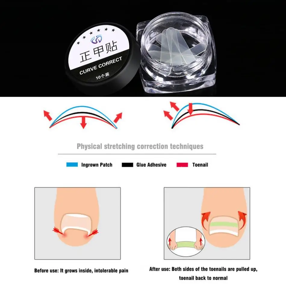 10Pcs/Box Ingrown Toenail Correction Pedicure Tool Ingrown Sticker Patch Toe Nail Fixer Recover Paronychia Correction Tool
10Pcs/Box Ingrown Toenail Correction Pedicure Tool Ingrown Sticker Patch Toe Nail Fixer Recover Paronychia Correction Tool