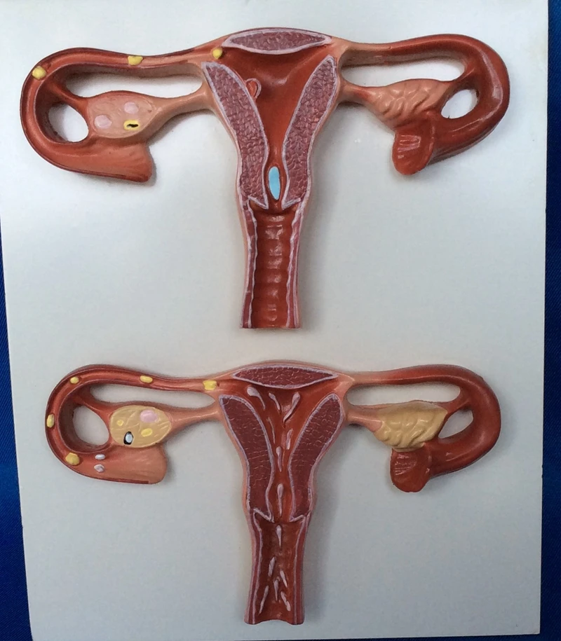 

Female Uterus Anatomy Model Pregnancy Model Fertilization Process Sperm In The Uterus Combined Development Process Model Ovary