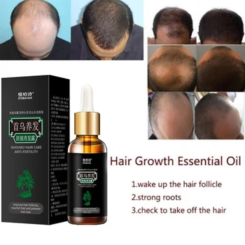 Hair Growth Essential Oils Essence Anti Hair Loss Liquid Dense Hair Growth Serum Hair Skin Care Good Use
Hair Growth Essential Oils Essence Anti Hair Loss Liquid Dense Hair Growth Serum Hair Skin Care Good Use