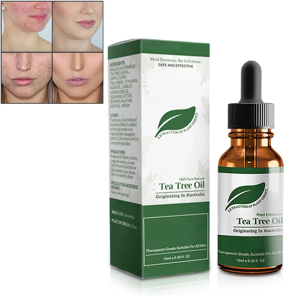 Antibacterial Anti-inflammatory Tea Tree Oil Moisturizing Tea Tree Essential Oil for Blemished Skin Anti-pimples Warts Fungus
Antibacterial Anti-inflammatory Tea Tree Oil Moisturizing Tea Tree Essential Oil for Blemished Skin Anti-pimples Warts Fungus