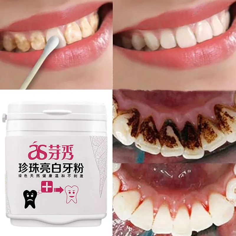 50g Gentle Dazzle Bright Powder Stains Removal Teeth Whitening Fresh Tooth Powder Oral Hygiene Cleaning Teeth Plaque Tartar
50g Gentle Dazzle Bright Powder Stains Removal Teeth Whitening Fresh Tooth Powder Oral Hygiene Cleaning Teeth Plaque Tartar