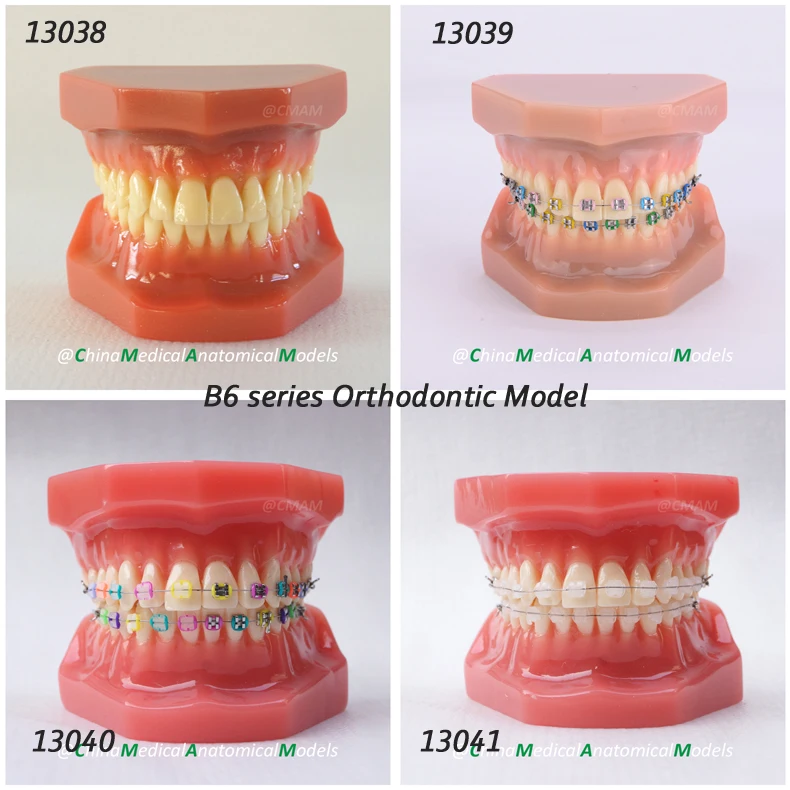 DH/13038, Orthodontic Model, 28pcs tooth, Solid Color Gum, Dentist Patient Communication Oral Dental Orthodontic Model
DH/13038, Orthodontic Model, 28pcs tooth, Solid Color Gum, Dentist Patient Communication Oral Dental Orthodontic Model