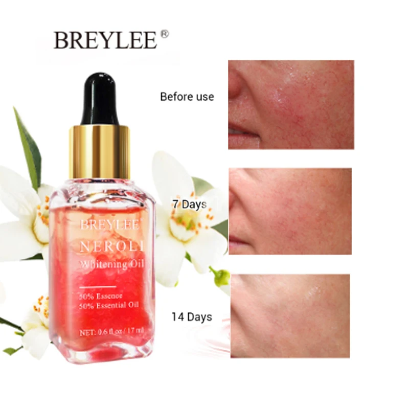 BREYLEE Neroli Whitening Essential Oils Fade Dark Spots Remove Face Freckle Brighten Skin Facial Serum Moisturizer Essence Oil
BREYLEE Neroli Whitening Essential Oils Fade Dark Spots Remove Face Freckle Brighten Skin Facial Serum Moisturizer Essence Oil