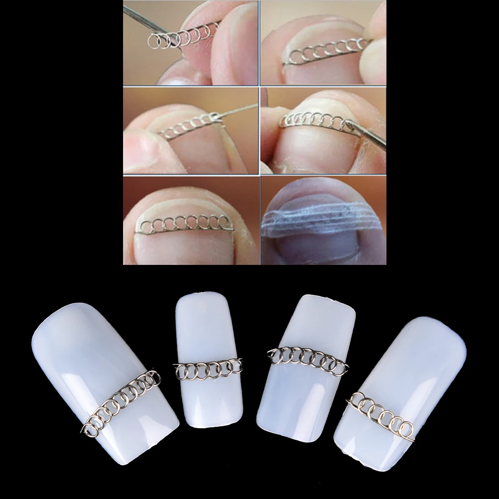 New Fixer Pedicure Recover Foot Care Nail Tool Correction Files Acronyx Wire Bunion Corrector For Toes Ingrown Toenails
New Fixer Pedicure Recover Foot Care Nail Tool Correction Files Acronyx Wire Bunion Corrector For Toes Ingrown Toenails