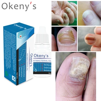 Nail Fungus Treatment / Onychomycosis Paronychia / Anti Fungal Nail Infection Good Result Chinese Herbal Toe Nail Treatment Oil
Nail Fungus Treatment / Onychomycosis Paronychia / Anti Fungal Nail Infection Good Result Chinese Herbal Toe Nail Treatment Oil