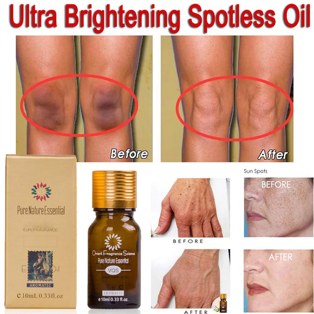 10ML Pure Natural Essential Ultra Brightening Spotless Oil Dark Spots Fade Away Age Spots Hyper Pigmentation Essential Oil
10ML Pure Natural Essential Ultra Brightening Spotless Oil Dark Spots Fade Away Age Spots Hyper Pigmentation Essential Oil