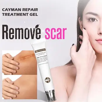 Hot Pro Acne Scar Removal Repair Scar Cream For Face Body Pigmentation Corrector Scalded Surgery Scar Insect Bites Mark Removal
Hot Pro Acne Scar Removal Repair Scar Cream For Face Body Pigmentation Corrector Scalded Surgery Scar Insect Bites Mark Removal