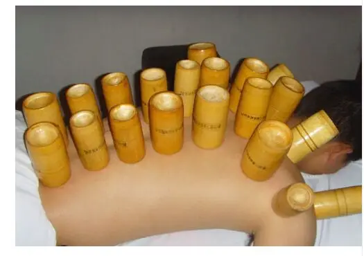 Best Quality Chinese Bamboo Cupping Cups+Free Gift Traditional Chinese Medicine Cupping Jar cupping treatment
Best Quality Chinese Bamboo Cupping Cups+Free Gift Traditional Chinese Medicine Cupping Jar cupping treatment