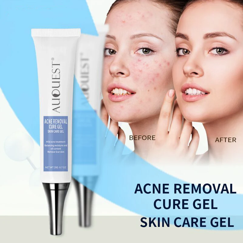 AuQuest Ginseng extract Acne Removal Cure Gel Blackhead Remover Acne Treatment Repair Cleaning Face Skin Cream Skin Care
AuQuest Ginseng extract Acne Removal Cure Gel Blackhead Remover Acne Treatment Repair Cleaning Face Skin Cream Skin Care