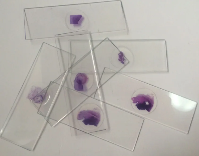 pathology slides (4)
