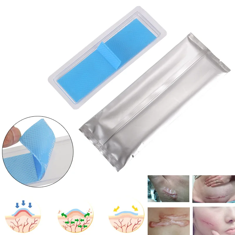 Silicone Removal Patch Reusable Acne Gel Scar Therapy Silicon Patch Remove Trauma Burn Sheet Skin Repair Hot Mdf
Silicone Removal Patch Reusable Acne Gel Scar Therapy Silicon Patch Remove Trauma Burn Sheet Skin Repair Hot Mdf