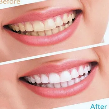 14pcs 7 Packs Advanced Teeth Whitening Strips 3D Ultra Gel Bleaching Tooth Whiten Teeth Oral Care Dental Hygiene clean tools
14pcs 7 Packs Advanced Teeth Whitening Strips 3D Ultra Gel Bleaching Tooth Whiten Teeth Oral Care Dental Hygiene clean tools