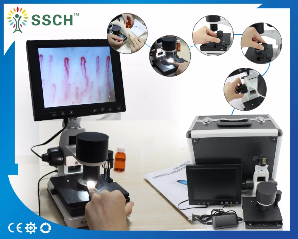 HOT HD microcirculation detector machine peripheral vascular wall A metallurgical microscope digital visualizer
HOT HD microcirculation detector machine peripheral vascular wall A metallurgical microscope digital visualizer