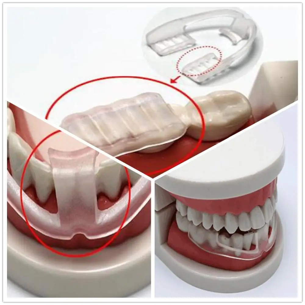 Mounchain Outdoor Tools Teeth Grinding Socket Dental Mouth Guard Bruxism Stop Clenching Sleep Aid Prevent Molar Braces
Mounchain Outdoor Tools Teeth Grinding Socket Dental Mouth Guard Bruxism Stop Clenching Sleep Aid Prevent Molar Braces