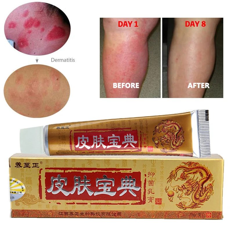 1PCS YIGANERJING Pifubaodian Original Psoriasis Dermatitis Eczema Pruritus Skin Problems Cream Without Retail Box
1PCS YIGANERJING Pifubaodian Original Psoriasis Dermatitis Eczema Pruritus Skin Problems Cream Without Retail Box