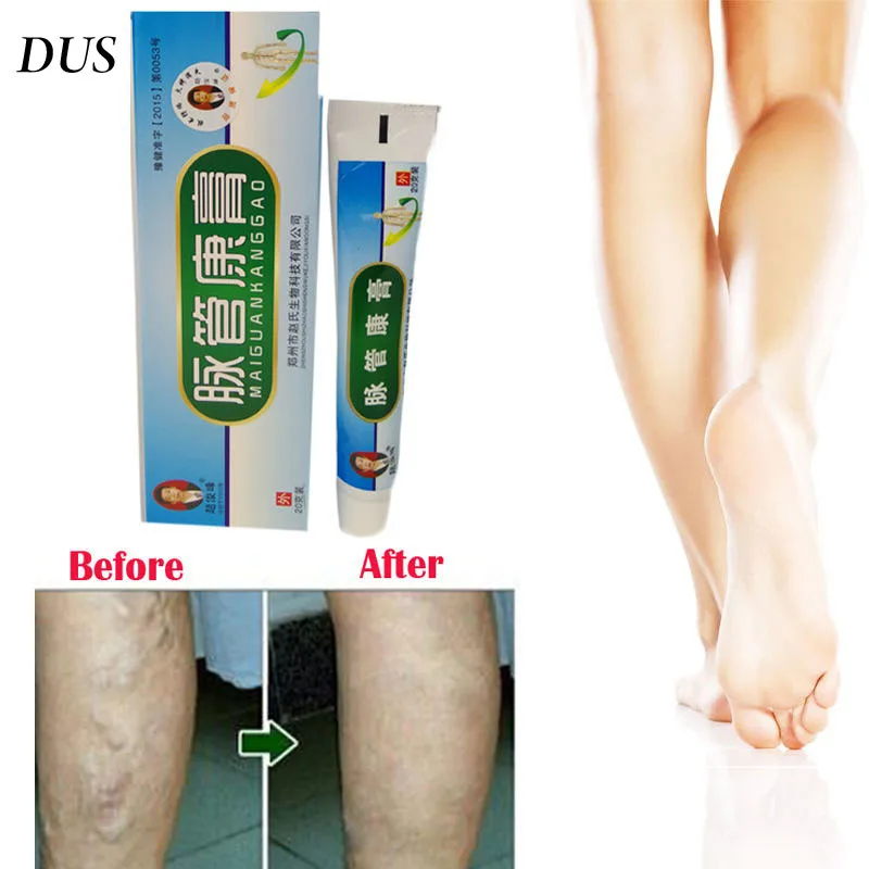 Varicose Veins ointment vasculitis treatment Phlebitis Angiitis inflammation blood vessel Rotten legs Varicose Veins Cream
Varicose Veins ointment vasculitis treatment Phlebitis Angiitis inflammation blood vessel Rotten legs Varicose Veins Cream