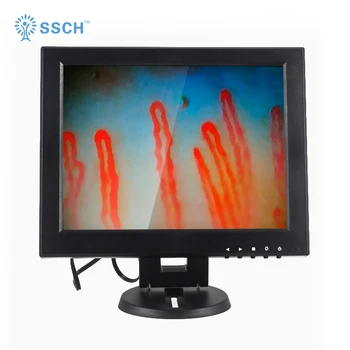 portable used digital led video blood capillary nailfold microscope microcirculation equipment/machine/detector
portable used digital led video blood capillary nailfold microscope microcirculation equipment/machine/detector