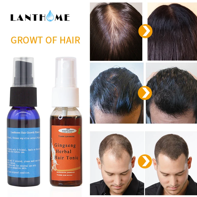 2pc Herbal Hair Tonic Spray Baldness Anti Hair Loss Treatment Alopecia Men Hair Care Women Fast Growth Hair Essence Vitamins Oil
2pc Herbal Hair Tonic Spray Baldness Anti Hair Loss Treatment Alopecia Men Hair Care Women Fast Growth Hair Essence Vitamins Oil
