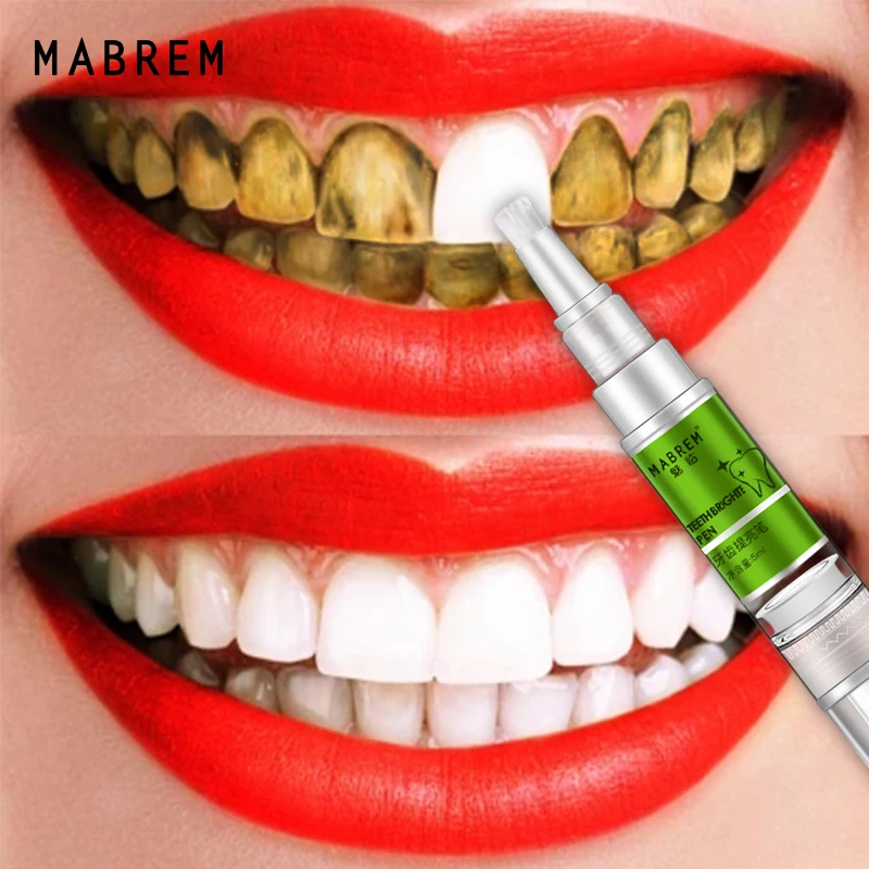 Teeth Brightening Pen Oral Hygiene Essence Teeth Whitening Serum Remove Plaque Stains Cleaning Water Smoke Stains Yellow Teeth
Teeth Brightening Pen Oral Hygiene Essence Teeth Whitening Serum Remove Plaque Stains Cleaning Water Smoke Stains Yellow Teeth