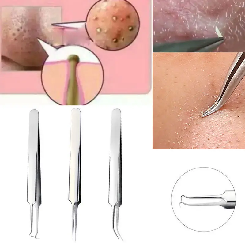 Face Black Dots Extractor Tweezers Blackhead Remover Acne Pimple Black Spots Removal Tweezer Comedone Extractor de cravo Makeup
Face Black Dots Extractor Tweezers Blackhead Remover Acne Pimple Black Spots Removal Tweezer Comedone Extractor de cravo Makeup