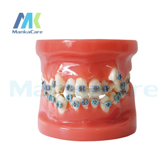 Manka Care - 28 шт. зубьев, цельнометаллический кронштейн, модель зубьев для полости рта
Manka Care - 28 шт. зубьев, цельнометаллический кронштейн, модель зубьев для полости рта