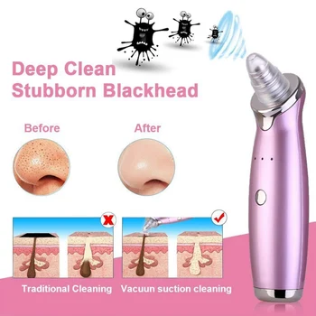 Blackhead Remover Acne Pimple Removal Vacuum Suction Tool Face Clean Facial Care Tools Diamond Dermabrasion Machine
Blackhead Remover Acne Pimple Removal Vacuum Suction Tool Face Clean Facial Care Tools Diamond Dermabrasion Machine