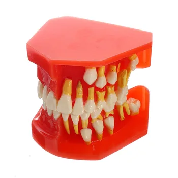Dental Tooth Teaching Model Children Permanent Tooth Alternative Model Deciduous Teeth Removable Demonstration For Kids Studying
Dental Tooth Teaching Model Children Permanent Tooth Alternative Model Deciduous Teeth Removable Demonstration For Kids Studying