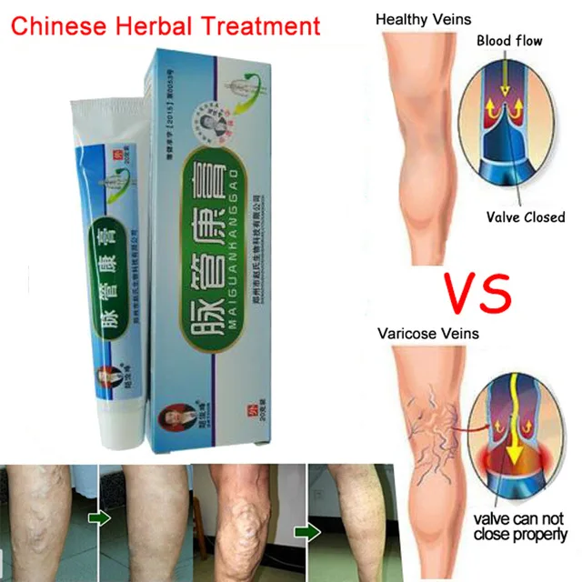 1-2 Pack Varicosity Medical Varicose Veins Cream Treatment Anti Foot Leg Vasculitis Phlebitis Herbal Product Foot Massager
1-2 Pack Varicosity Medical Varicose Veins Cream Treatment Anti Foot Leg Vasculitis Phlebitis Herbal Product Foot Massager