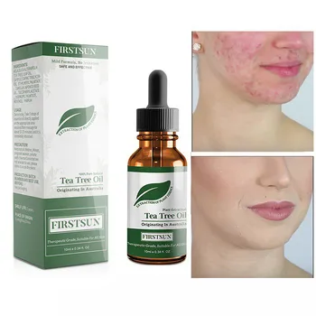 100% Tea Tree Pure Essential Oil Cosmetics For Face Care Skin Acne Treatment Oil Blackhead Remover Anti Spots Facial Undefined
100% Tea Tree Pure Essential Oil Cosmetics For Face Care Skin Acne Treatment Oil Blackhead Remover Anti Spots Facial Undefined