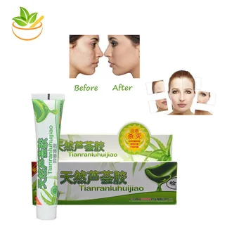 30g*5pcs Aloe Vera Gel Skin Care Face Cream Hyaluronic Acid Anti Winkle Whitening Moisturizing Acne Treatment Cream Natural
30g*5pcs Aloe Vera Gel Skin Care Face Cream Hyaluronic Acid Anti Winkle Whitening Moisturizing Acne Treatment Cream Natural