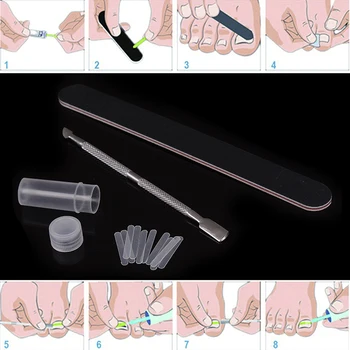 1 Set Nail Correction Tool Ingrown Toenail Correction Kit Nail File Toenail Straightening Patch Pusher Recover Foot Care
1 Set Nail Correction Tool Ingrown Toenail Correction Kit Nail File Toenail Straightening Patch Pusher Recover Foot Care
