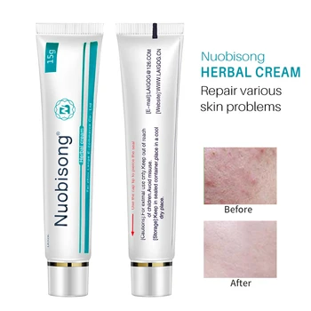 NUOBISONG 3pcs skin care product relieve Psoriasis Dermatitis Eczema Pruritus effect Have Retail Box Hot Selling
NUOBISONG 3pcs skin care product relieve Psoriasis Dermatitis Eczema Pruritus effect Have Retail Box Hot Selling