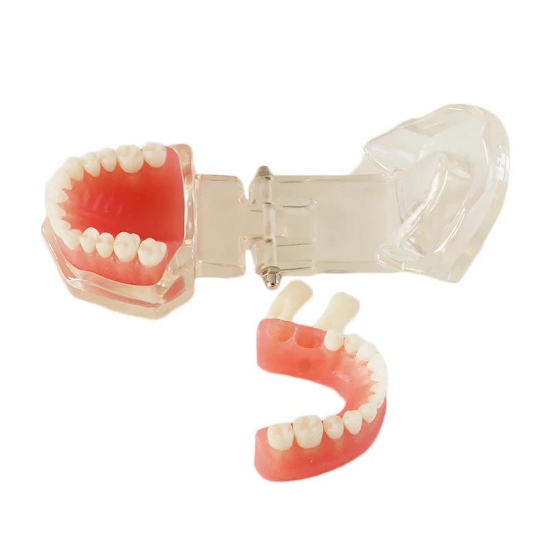 Denture Dental Teaching model Dental Removable Model 28 tooth Without screw
Denture Dental Teaching model Dental Removable Model 28 tooth Without screw