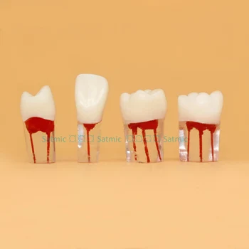 4pcs/lot Tooth Root Canal Model for RCT Practice Transparent Resin with Pulp Cavity & Dyed Root Canal
4pcs/lot Tooth Root Canal Model for RCT Practice Transparent Resin with Pulp Cavity & Dyed Root Canal