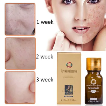 10ML Pure Natural Essential Ultra Brightening Spotless Oil Dark Spots Fade Away Age Spots Hyper Pigmentation Essential Oil
10ML Pure Natural Essential Ultra Brightening Spotless Oil Dark Spots Fade Away Age Spots Hyper Pigmentation Essential Oil