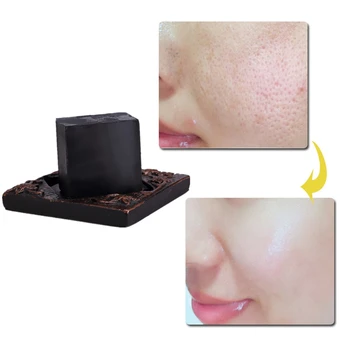 Chinese Medicine Moisturizing Facial Soap Face Washing Product Skin Care Anti Aging Wrinkle Treatment Blackhead Cleansing
Chinese Medicine Moisturizing Facial Soap Face Washing Product Skin Care Anti Aging Wrinkle Treatment Blackhead Cleansing