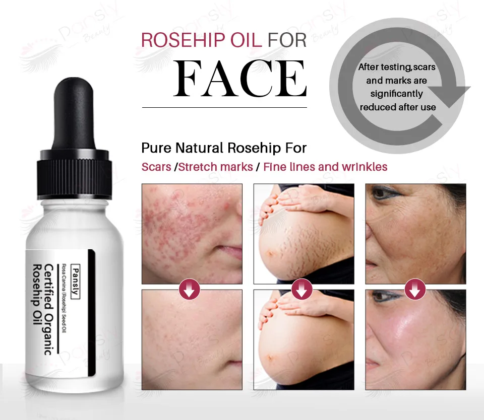 Rosehip Oil Anti-Aging Whitening Moisturizer Rose Hip Essential Oil Skin Care Acne Scar Serum Remove Stretch Marks natural oil
Rosehip Oil Anti-Aging Whitening Moisturizer Rose Hip Essential Oil Skin Care Acne Scar Serum Remove Stretch Marks natural oil