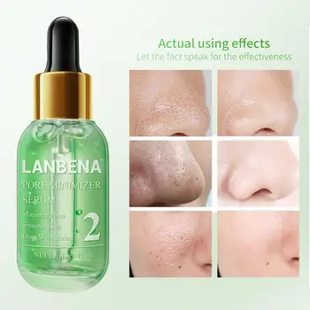 Blackhead Remover Kit Deep Pore Cleaning Shrinking Pores Purifying Acne Treatment Essence Smoothing For Skin Care
Blackhead Remover Kit Deep Pore Cleaning Shrinking Pores Purifying Acne Treatment Essence Smoothing For Skin Care
