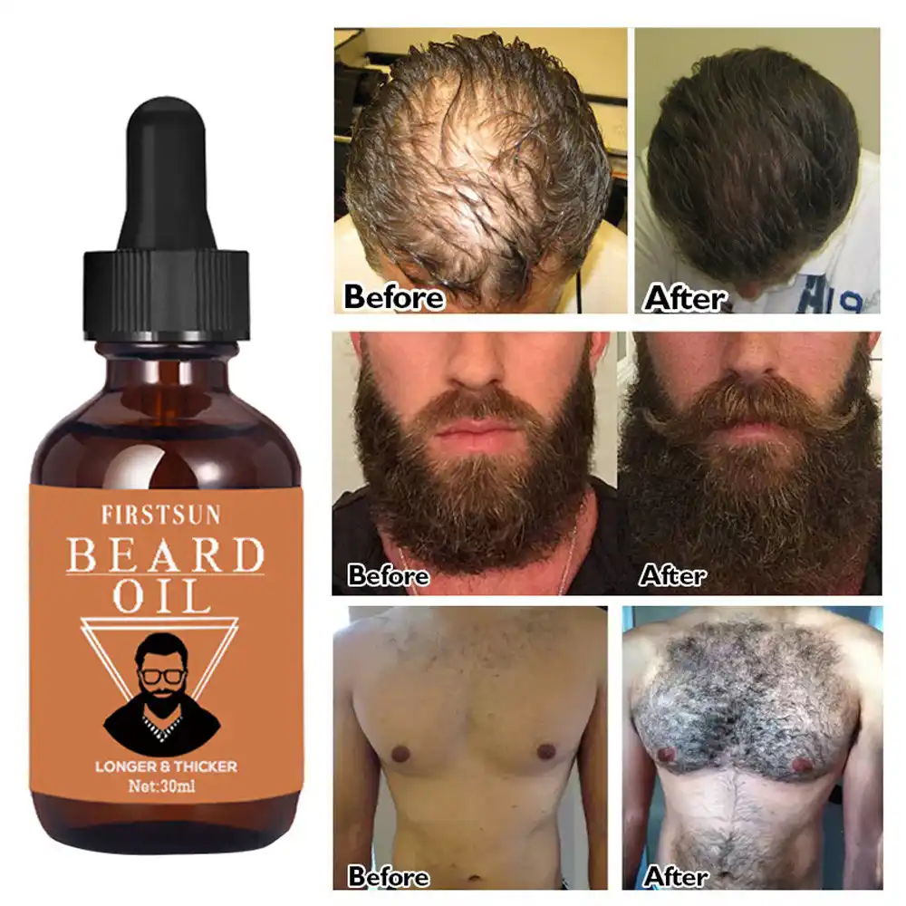 30ml Hair Beard Growth Thicker Essence Hair Growth Fluid 4 Colors