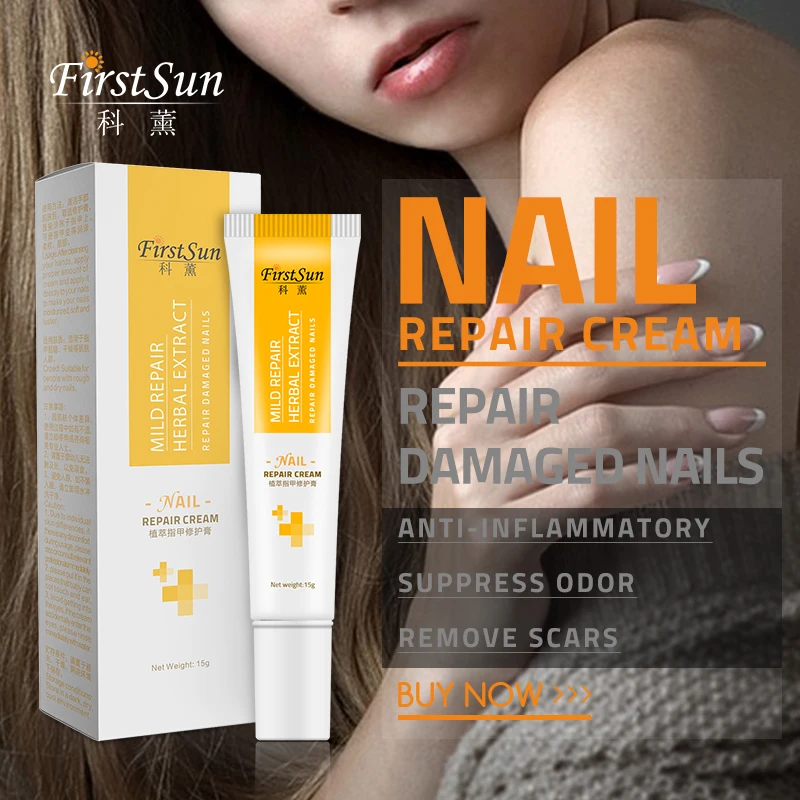 Firstsun Toe Anti Nail Fungus Infection Treatment Cream Herbal Onychomycosis Paronychia Treatment Nail Podiatry Repair
Firstsun Toe Anti Nail Fungus Infection Treatment Cream Herbal Onychomycosis Paronychia Treatment Nail Podiatry Repair