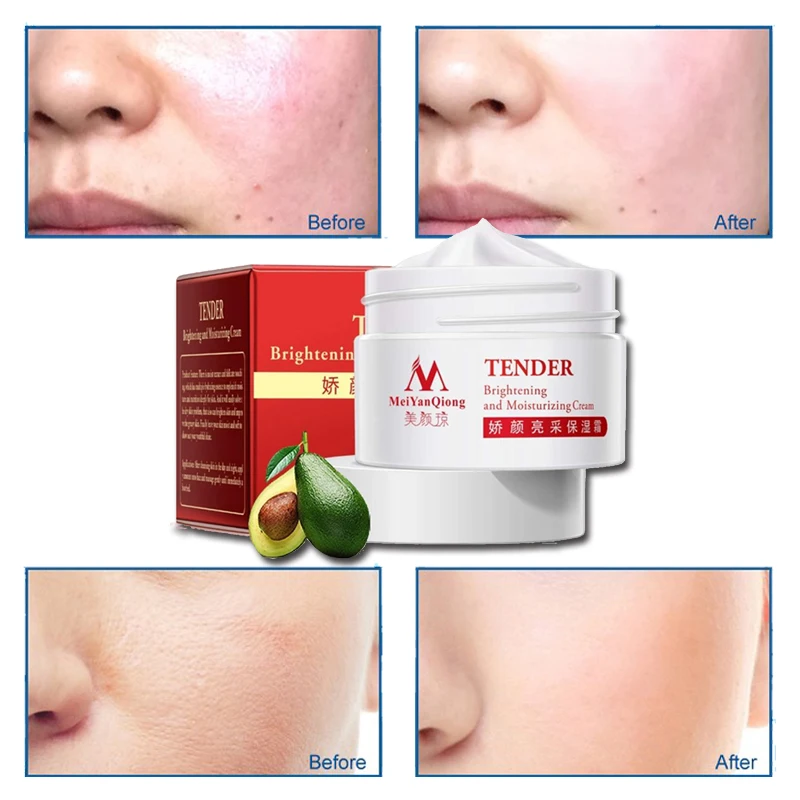 Skin care lightening whitening moisturizer face cream lift anti aging wrinkle remover creme cremashidratante faciales anti edad
Skin care lightening whitening moisturizer face cream lift anti aging wrinkle remover creme cremashidratante faciales anti edad