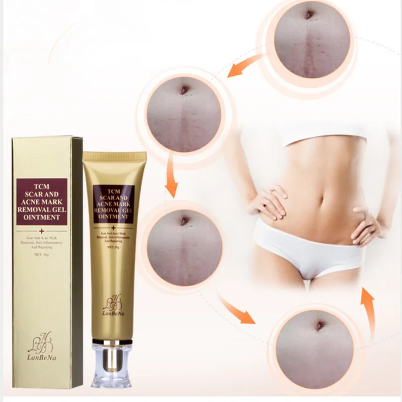 Acne Scar Cream Ginseng Essence Anti Acne Remover Cream Face Care Makeup Spots Stretch Marks Remove Scar Product LANBENA
Acne Scar Cream Ginseng Essence Anti Acne Remover Cream Face Care Makeup Spots Stretch Marks Remove Scar Product LANBENA