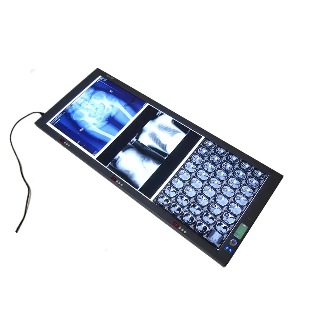 LED Viewing Box, X Ray Viewer, Negatoscope, Medical Film Viewer triple Screen Zg-3c
LED Viewing Box, X Ray Viewer, Negatoscope, Medical Film Viewer triple Screen Zg-3c