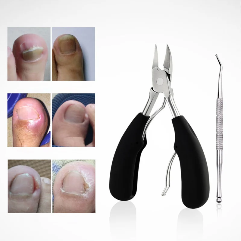 

Stainless Steel Fingernail & Toenail Cuticle Nipper Trimming Scissor Nail Clipper Cutter For Thick Ingrown Toenails Manicure set