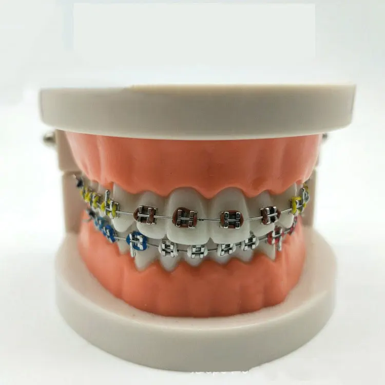 Dental Material Orthodontic braces metal bracket bow wire teaching oral correction model false teeth snap materiales retainers
Dental Material Orthodontic braces metal bracket bow wire teaching oral correction model false teeth snap materiales retainers