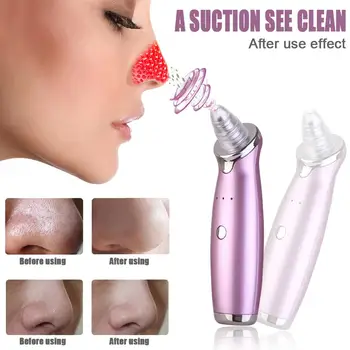 Vacuum Pore Cleaner Blackhead Remover Facial Acne Pimple Removal Suction Tool Face Clean Machine Skin Care Tool
Vacuum Pore Cleaner Blackhead Remover Facial Acne Pimple Removal Suction Tool Face Clean Machine Skin Care Tool