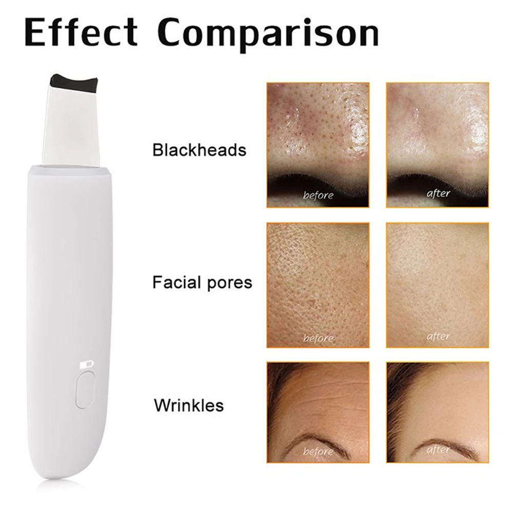 Hailicare Ultrasonic Face Cleaning Machine Skin Scrubber Remove Dirt Blackhead Reduce Wrinkles Facial Lifting Tools
Hailicare Ultrasonic Face Cleaning Machine Skin Scrubber Remove Dirt Blackhead Reduce Wrinkles Facial Lifting Tools