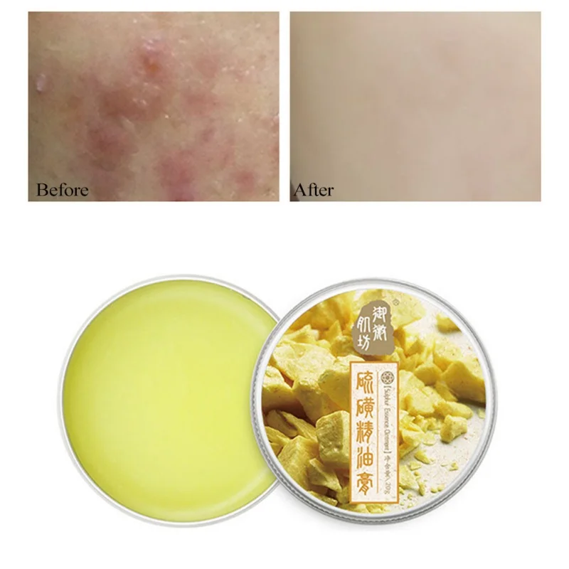 Deep Moisturizing Sulfur Essence Face Cream Hydrating Anti Wrinkle whitening Lift Day Creams Skin Care
Deep Moisturizing Sulfur Essence Face Cream Hydrating Anti Wrinkle whitening Lift Day Creams Skin Care